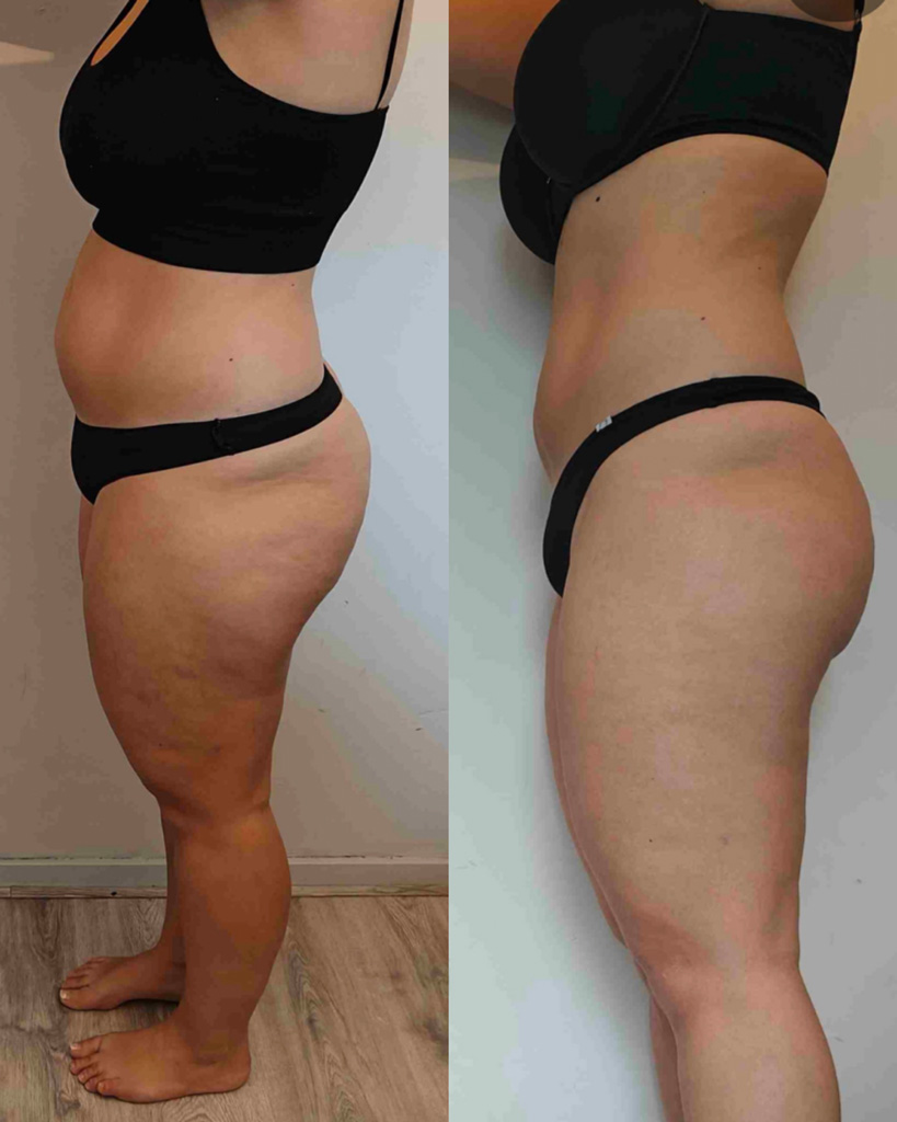 Transformation 4
